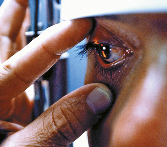 LIFESTYLE SALUD | Los ojos son una ventana para detectar enfermedades LIFESTYLE SALUD | Los ojos son una ventana para detectar enfermedades
