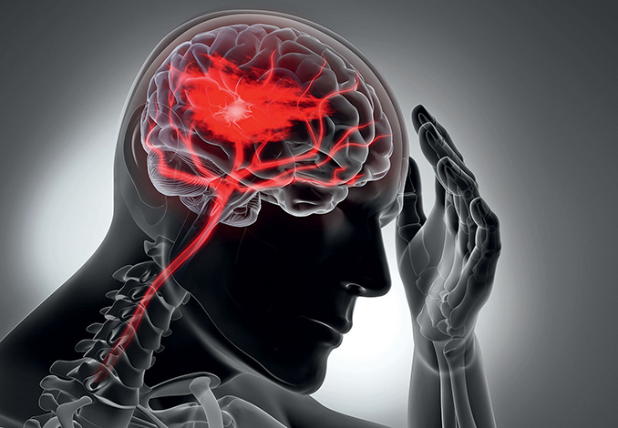 ESPECIALES LIFESTYLE SALUD | Tratamientos contra la epilepsia ESPECIALES LIFESTYLE SALUD | Tratamientos contra la epilepsia